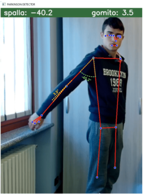 PARKINSON DETECTOR: intelligenza artificiale e medicina - 2FZV1mkdw6pVB.png