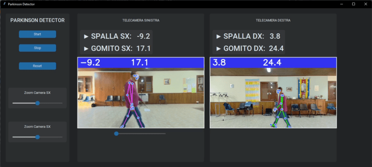 PARKINSON DETECTOR: intelligenza artificiale e medicina - 2gtK3FEIZb2Jx.png